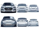 Hyundai Sonata Facelift Teased — Now More Aggressive Than Ever