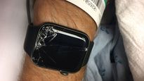 Apple Watch Saves Mountain Biker’s Life After Crash By Alerting Emergency Services