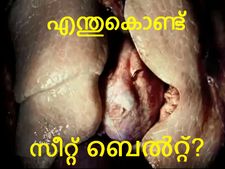 'എന്നാത്തിനാ ഈ സീറ്റ് ബെല്‍റ്റ്' എന്നു ചോദിക്കുന്നവര്‍ക്ക്