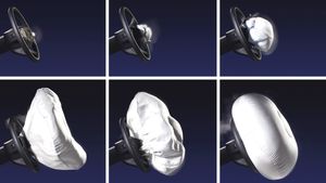 എയർബാഗുകളെ കുറിച്ച് എന്തൊക്കെ അറിയാം; ഈ കാര്യങ്ങൾ ശ്രദ്ധിക്കാൻ മറക്കരുത്