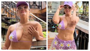 Evelin Gomez breast removed due to breast cancer Evelin Gomez shows her daring cancer recovery journey