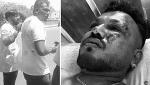 ఎమర్జెన్సీ ఎగ్జిట్ దగ్గర కూర్చుంటే బతికేస్తారా? 11A సీటులో కూర్చుంటే ప్రాణాలు సేఫా ? బతికి బయటపడ్డ రమేష్ కథ !