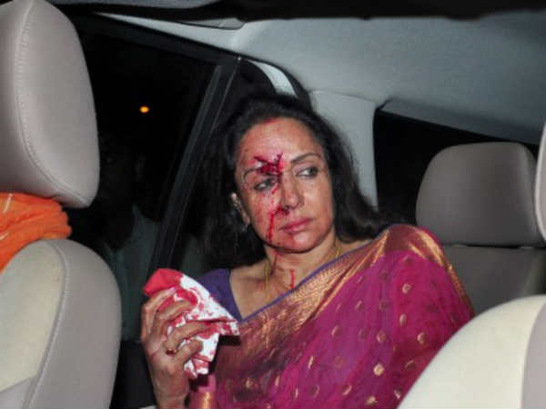 हेमा मालिनी रोड़ एक्‍सीडेंट • तो ये है हादसे का कारण 