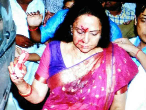 हेमा मालिनी रोड़ एक्‍सीडेंट • तो ये है हादसे का कारण 