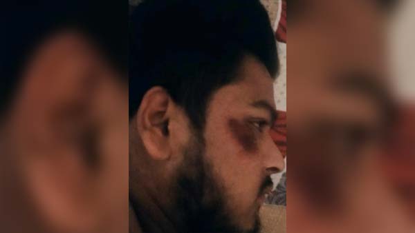 प्रैंक विडियो बनाते समय बीच रोड पर हुंडई आई 10 ने यूट्यूबर को उड़ाया - देखें विडियो प्रैंक विडियो बनाते समय बीच रोड पर हुंडई आई 10 ने यूट्यूबर को उड़ाया - देखें विडियो