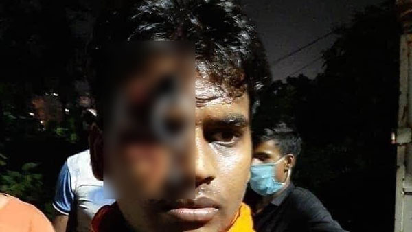 हेलमेट न पहनने पर पुलिस ने युवक का किया ऐसा हाल, देखकर हो जाएंगे हैरान हेलमेट न पहनने पर पुलिस ने युवक का किया ऐसा हाल, देखकर हो जाएंगे हैरान