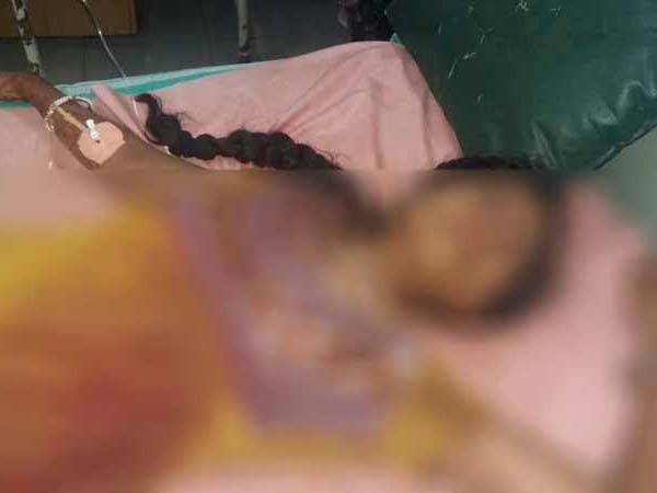 ಮದುವೆ ದಿಬ್ಬಣದ ಟೆಂಪೋ ಮತ್ತು ಖಾಸಗಿ ಬಸ್ ನಡುವೆ ಡಿಕ್ಕಿ- ವಧು ಸೇರಿ 7 ಮಂದಿ ದುರ್ಮರಣ