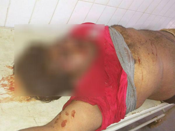 ಅಪಘಾತದಲ್ಲಿ ಕನ್ನಡದ ಖ್ಯಾತ ಸೀರಿಯಲ್ ನಟಿ ರಚನಾ ಮತ್ತು ಸಹನಟ ಜೀವನ್ ಸಾವು 