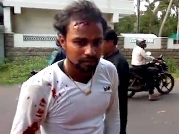 ಹೆಲ್ಮೆಟ್ ಹಾಕಿಲ್ಲವೆಂದು ಹೆಣ ಉರುಳಿಸೋ ಪೊಲೀಸರನ್ನು ನೋಡಿದ್ದೀರಾ? ಹೆಲ್ಮೆಟ್ ಹಾಕಿಲ್ಲವೆಂದು ಹೆಣ ಉರುಳಿಸೋ ಪೊಲೀಸರನ್ನು ನೋಡಿದ್ದೀರಾ?