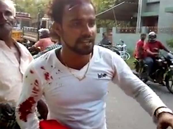 ಹೆಲ್ಮೆಟ್ ಹಾಕಿಲ್ಲವೆಂದು ಹೆಣ ಉರುಳಿಸೋ ಪೊಲೀಸರನ್ನು ನೋಡಿದ್ದೀರಾ? ಹೆಲ್ಮೆಟ್ ಹಾಕಿಲ್ಲವೆಂದು ಹೆಣ ಉರುಳಿಸೋ ಪೊಲೀಸರನ್ನು ನೋಡಿದ್ದೀರಾ?