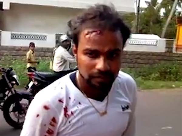 ಹೆಲ್ಮೆಟ್ ಹಾಕಿಲ್ಲವೆಂದು ಹೆಣ ಉರುಳಿಸೋ ಪೊಲೀಸರನ್ನು ನೋಡಿದ್ದೀರಾ? ಹೆಲ್ಮೆಟ್ ಹಾಕಿಲ್ಲವೆಂದು ಹೆಣ ಉರುಳಿಸೋ ಪೊಲೀಸರನ್ನು ನೋಡಿದ್ದೀರಾ?