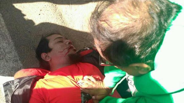 ಎಮ್ಮೆಗೆ ಗುದ್ದಿದ ಡುಕಾಟಿ ಸೂಪರ್ ಬೈಕ್- ಸವಾರ ಸ್ಥಳದಲ್ಲೇ ಸಾವು