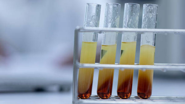 ಪ್ರತಿ ಲೀಟರಿಗೆ 38 ಕಿ.ಮೀ ಮೈಲೇಜ್ ನೀಡುತ್ತದೆ ಕೋಳಿ ತ್ಯಾಜ್ಯದಿಂದ ತಯಾರಾಗುವ ಈ ಬಯೋ ಡೀಸೆಲ್