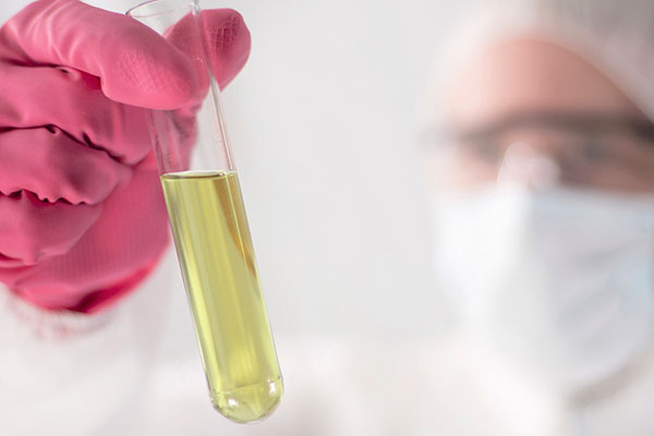 ಪ್ರತಿ ಲೀಟರಿಗೆ 38 ಕಿ.ಮೀ ಮೈಲೇಜ್ ನೀಡುತ್ತದೆ ಕೋಳಿ ತ್ಯಾಜ್ಯದಿಂದ ತಯಾರಾಗುವ ಈ ಬಯೋ ಡೀಸೆಲ್