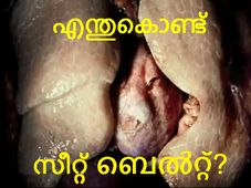 'എന്നാത്തിനാ ഈ സീറ്റ് ബെല്‍റ്റ്' എന്നു ചോദിക്കുന്നവര്‍ക്ക്