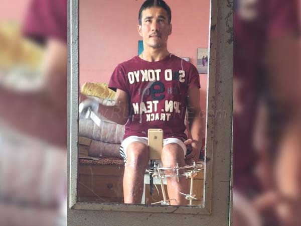 കാറിലേക്ക് ഇടിച്ച് കയറി ഡ്യൂക്ക് 390; ഇത് പ്രതിസന്ധിയിലും ജീവിതം തിരിച്ചുപിടിച്ച റൈഡറുടെ കഥ