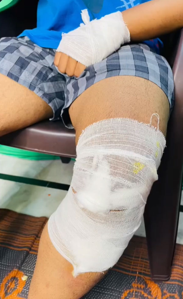 Mahindra Scorpio -ൽ സിനിമ സ്റ്റൈൽ ഹിറ്റ് ആന്റ് റൺ! ഒരു നിമിഷത്തെ കോപത്തിന് ഉടമയ്ക്ക് എട്ടിന്റെ പണി