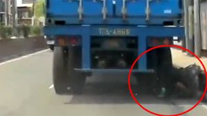 தலை மீது லாரி ஏறியும் உயிர் தப்பிய வாலிபர்: அதிர்ச்சியில் உறைய வைத்த சம்பவம் 