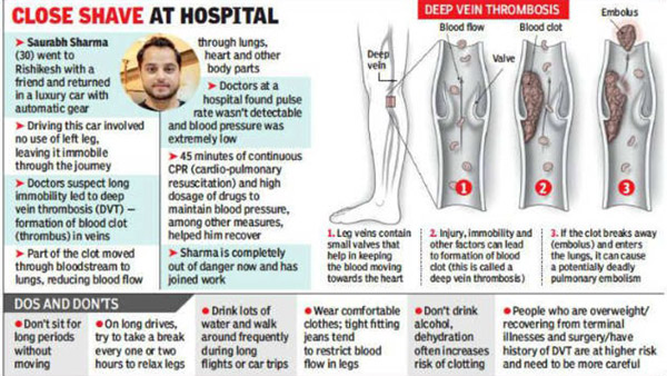 நீண்ட தூர பயணத்தின்போது இறுக்கமாக ஜீன்ஸ் அணிய கூடாது... ரொம்ப ஆபத்தானதாம்! எப்படி தெரியுமா?