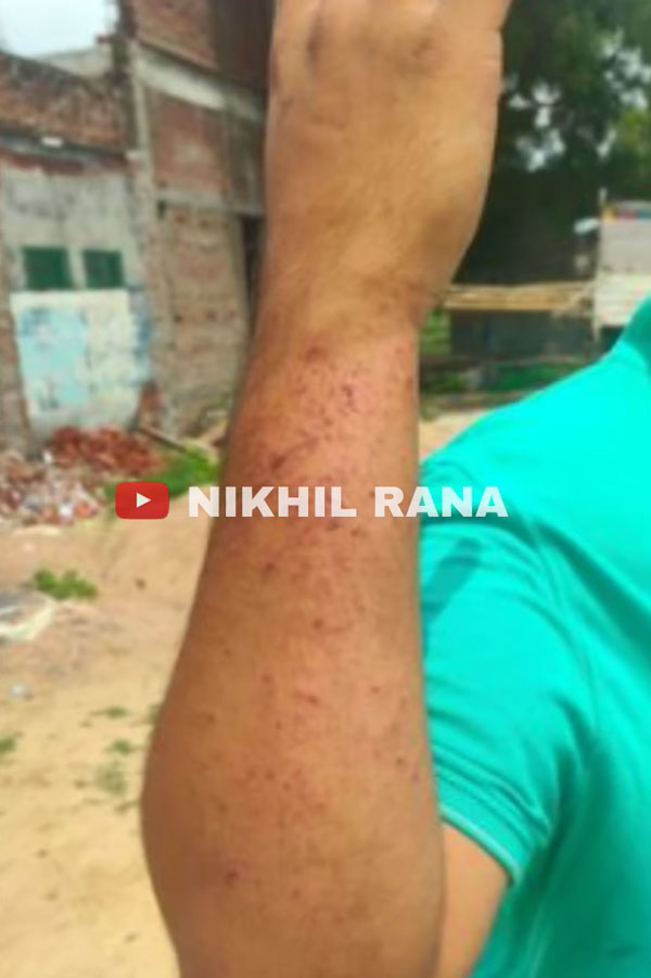 சேதத்தை பாத்து கணக்கு போடாதீங்க... உள்ள இருந்தவங்களுக்கு என்ன ஆச்சு தெரிஞ்சா மூக்குமேல விரல வைப்பீங்க! அட சே இந்த காரை மிஸ் பண்ணிட்டோமே!