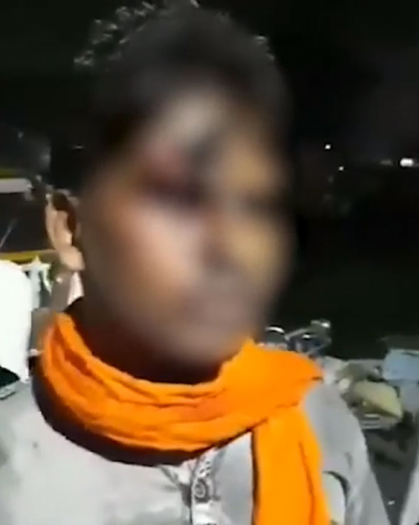 హెల్మెట్ ధరించనందుకు నుదుటిపై బైక్ కీ తో పొడిచిన పోలీస్, తర్వాత ఏం జరిగిందంటే